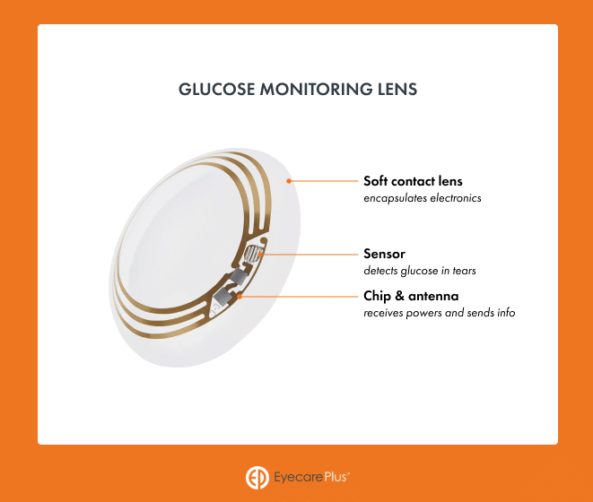 Intraocular Pressure Lens