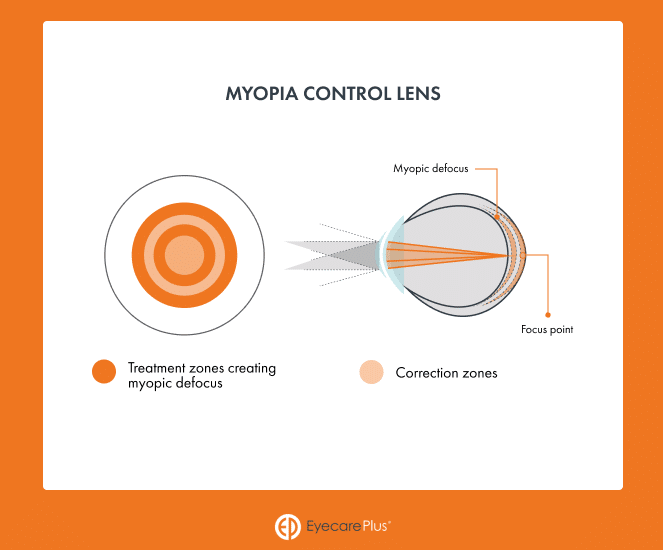 Functional Advancements